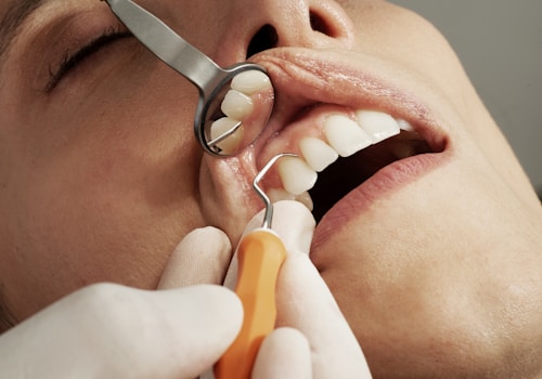 Smile Makeover
